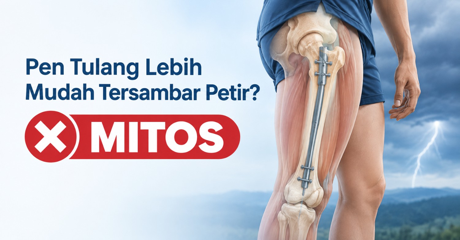 pen tulang atau implan ortopedi dan mitos risiko tersambar petir